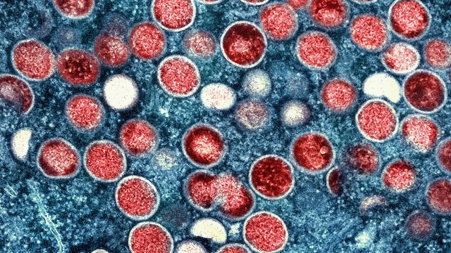 MED WHO Mpox 